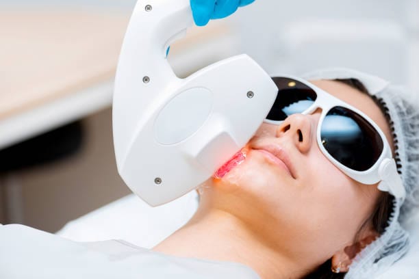 well health laser technology